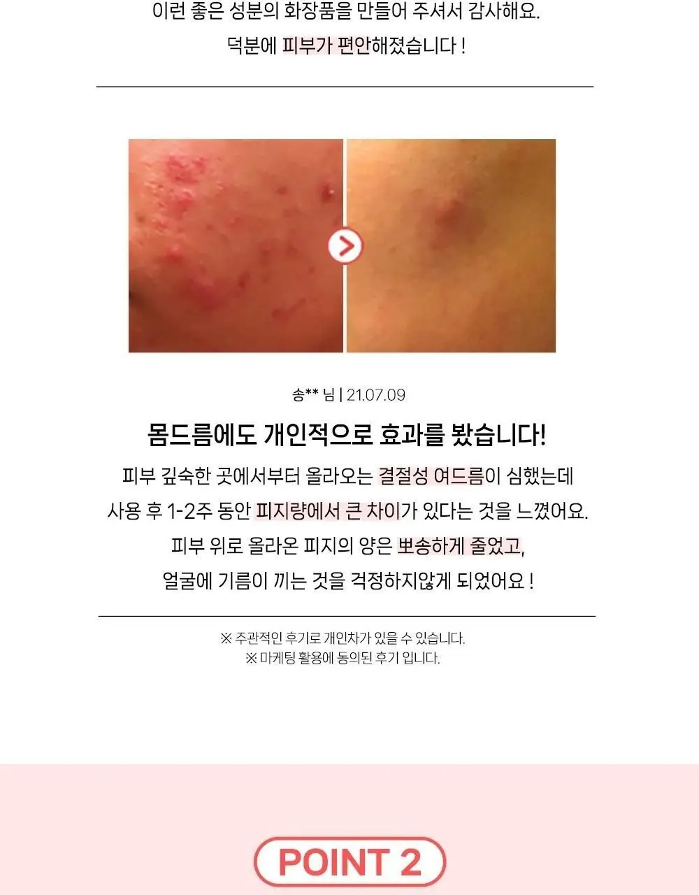 [여드름기능성/약알칼리성] 아토뮤 아크리스 폼클렌저 120ml 상세페이지 17